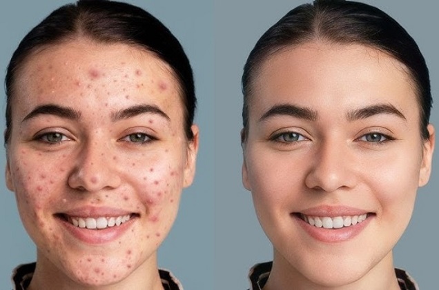 How to Retouch a Face Without Losing